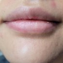 올리브영 비건립밤 <b>후루</b><b>디아</b> 리프루스트 어때?