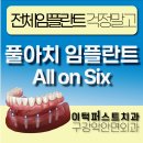 아치치과기공소 이미지