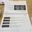 서울리거피부과 더블업 울쎄라피프라임으로 통증 시간 줄인 효과 후기