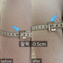 광산구-145 | 1회만으로도 복부 -4cm?! LPG엔더몰러지 바디관리 리얼후기 차오르다 에스테틱 광주첨단점
