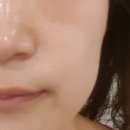 [수원/화성 피부관리] 여우스킨 봉담피부관리, 두번째 방문 후기~♡