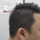 일산헤어라인문신 쿤스트디뷰티연구소 3차 기다리셨죠 !