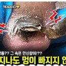 축구와 맞바꾼 발톱! 그 속은 만신창이!?? 시간이 지나도 멍이 안빠져서 왔어요ㅠㅠ 이미지