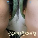 순수비타민C가 들어간 닥터샘킴 서울리거뷰티 미백화장품 순수비타민C세럼 리얼후기