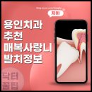 용인 치과 추천 매복 사랑니 발치 비용과 상처 회복기간