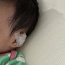 신생아 귀교정기 꼭 필요할까? 셀프 귀교정 해본 리얼 후기