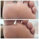 네일&풋 | 아직도 티눈 내성발톱 참고 계신가요 새발탄생 발톱발각질 세트관리 네일 풋 가우다 후기