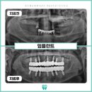 올봄플란트치과의원 | 병점임플란트잘하는곳 올봄에서 치료하고 인생이 바뀌었어요!