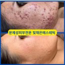 피부숨쉬다 이미지