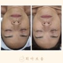 희메디칼 네이버블로그