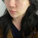 연예인 | 청담 티타늄리프팅 후기 연예인 방문 피부과