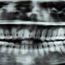 명성치과의원 | 과잉진료 없는 부곡동 명성 치과 후기