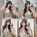 디의원 | 레디어스 앞볼 팔자 후기 + 리바이브 효과｜강남 디토셀 의원