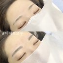 라디브로우
