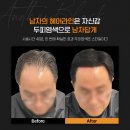 아인뷰티랩 티스토리