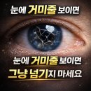 송탄성모안과의원 네이버블로그