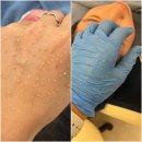 내서읍1294(광려로) | 마산여드름전문 조슈아스킨랩 임상