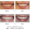 미소라인
