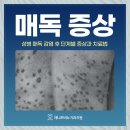 천호동비뇨기과 매독 증상 잠복기 빠른 치료 중요한 이유