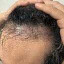 모바른의원 이미지