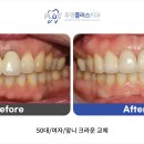 플러스치과기공소 이미지