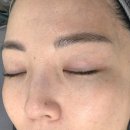 뷰티초이스 | 구래동 피부관리 맛집 초이스뷰티 플라즈마 관리 후기