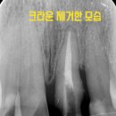 보강치과기공소 이미지