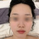 미플러스 | 인천 피부관리 1:1 맞춤 솔루션, <미플러스 에스테틱> 맞춤 케어 솔직 리뷰