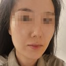 내안에스킨앤바디 | 성서피부관리 내안에스킨앤바디 미백관리 후기