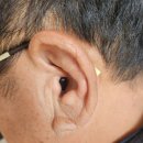 부안보청기 이미지