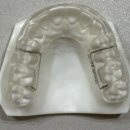 스페셜기공소 이미지