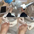 레푸스 화정점 | 고양 내성발톱 전문 클리닉, 레푸스 화정점 발관리 후기