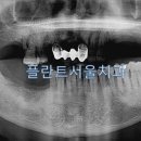 서울플란트치과 이미지