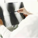 운동처방재활 이미지