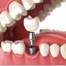 마리치과의원 이미지