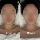 동성로 관광안내소 | 대구 얼굴 경락 잘하는 곳 / 유에보 에스테틱 작은얼굴 윤곽관리 후기