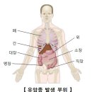 직장 유암종[Rectal Carcinoid Tumor]소화기질환, 종양혈액질환 이미지