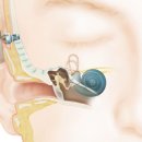 파워보청기 이미지