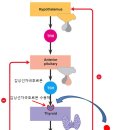 갑상선기능항진증은 왜 생기는건가요? 안구돌출은 피할수없나요? 안구돌출이 생기면 어떻게 치료할수있나요? 이미지