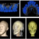 전산화단층촬영술[Computed tomography (CT)] 이미지