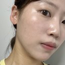 필옵틱스3공장 | 울트라클리어 모공 기미 잡티 레이저 효과 수원피부과 내돈내산 후기
