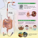 [재미있는 과학] '건강한 똥'에서 추출한 유익한 미생물로 장 건강 지켜요 이미지