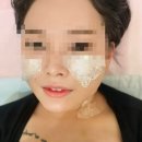 서울뷰의원 당진 네이버블로그