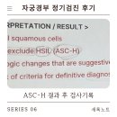 경부 | 자궁경부 정기검진 후기 | ASC-H 결과부터 조직 검사 결정까지