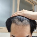 모디헤어플란트의원 이미지