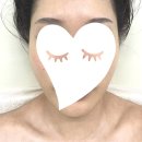 써니미르 | [물금피부관리] 20년 경력 원장님 ㅣ 데콜테까지 완벽했던 양산하이푸 관리 <뷰티마인>