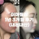 파란치과의원 | 이마필러 1년 후 아직도 남아있을까? 이마필러 1년 후 솔직 후기