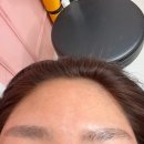 세라헤어라인 이미지