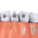 아름다운바른이치과교정과치과의원 이미지