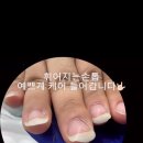 알토네일